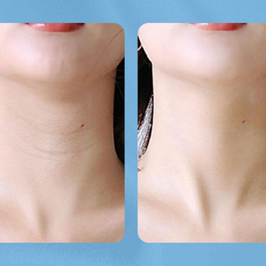 Masażer do twarzy i szyi LED – urządzenie do liftingu i terapii światłem